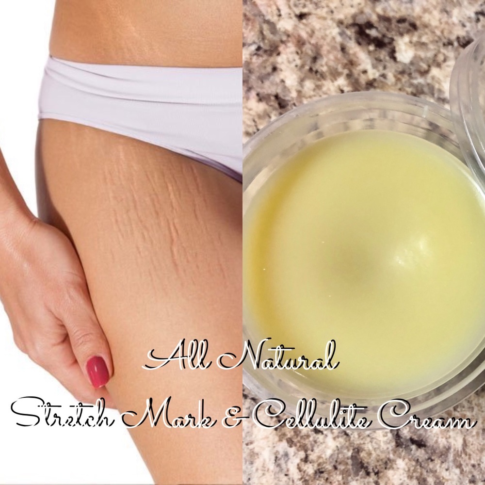All Natural Scar Cellulite Stretch Mark Cream 2.5oz